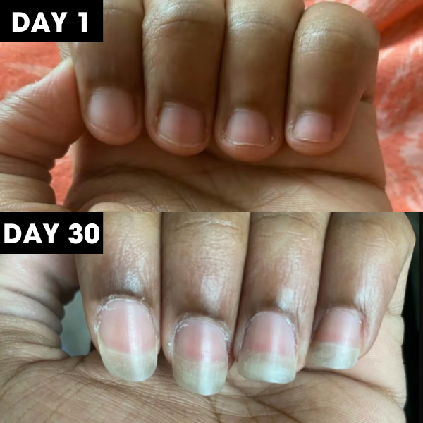 Lunoox™ Cuticle & Nail Oil Pen (Buy 1 Get 2 Free)