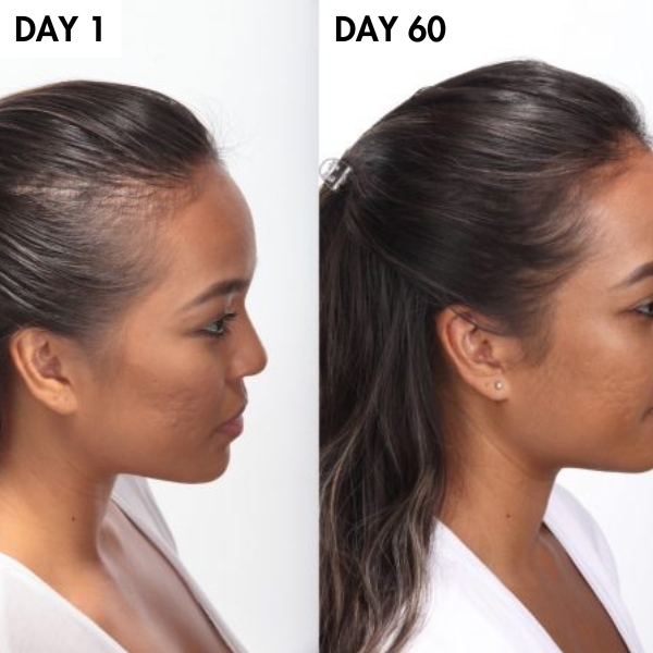 Lunoox™ Unrefined Batana Hair Oil (Buy 1 Get 1 Free)