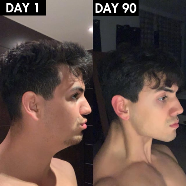 Lunoox™ Mouth Tape