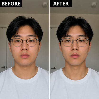 Lunoox™ LED Lymphatic Facial Drainer