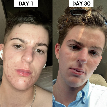 Lunoox™ Organic Silk Pillowcase (Buy 1 Get 1 Free)