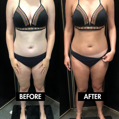 Carroten™ Intensive Tanning Gel by Lunoox (150 ml)