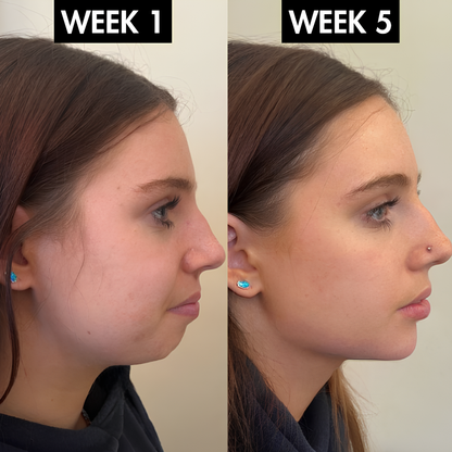 Lunoox™ EMS Facial Massager