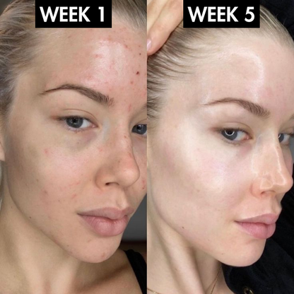 Lunoox™ EMS Facial Massager