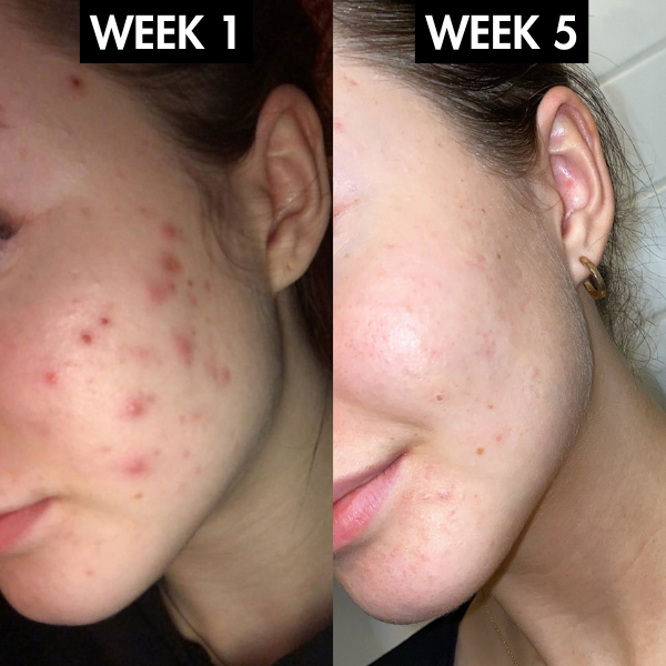 Lunoox™ EMS Facial Massager