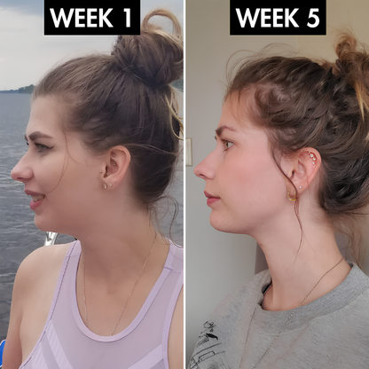 Lunoox™ EMS Facial Massager